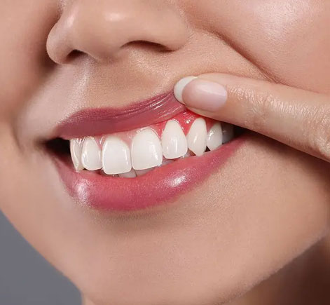 Close-up of smiling person displaying bright, healthy white teeth and pink lips.