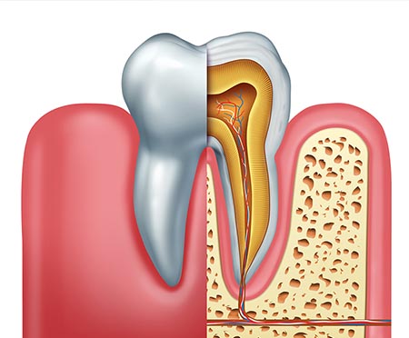Tooth cross-section diagram showing internal anatomy including pulp, nerves, and bone structure.